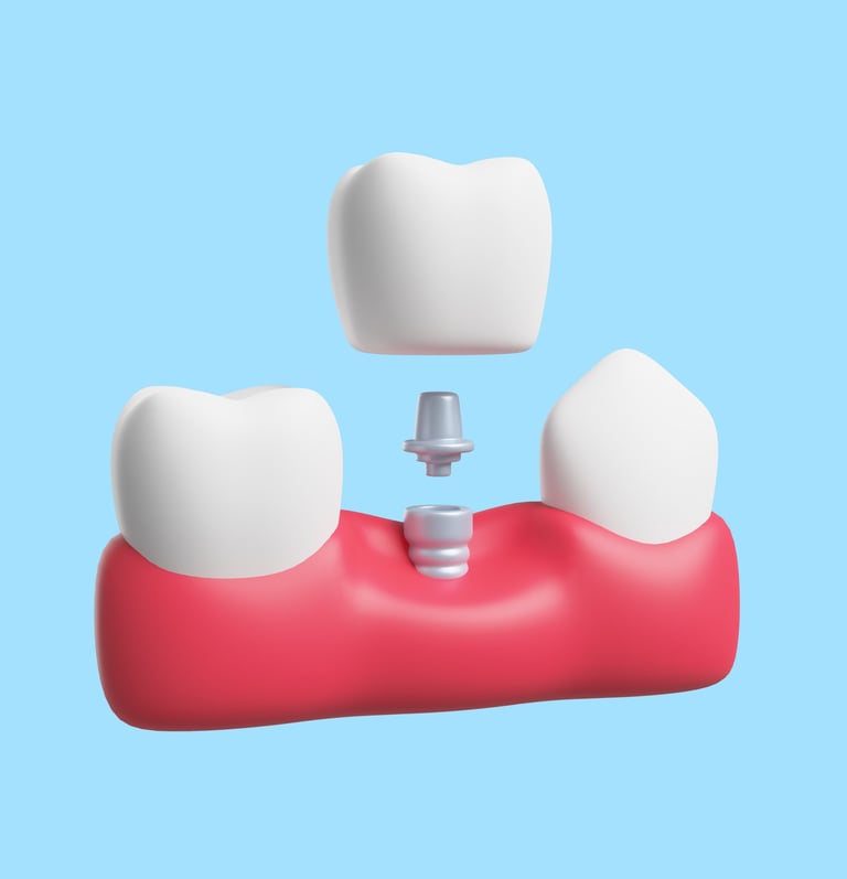 Fixed denture