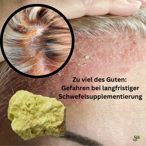 Schuppen bei langfristiger Schwefelsupplementierung