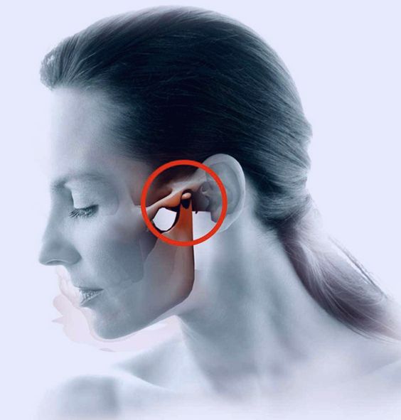Tratamento para dor temporomandibular e DTM em Curitiba com especialista.