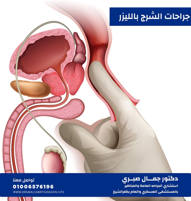 جراحــات الشرج كفرالشيخ