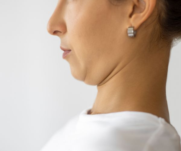 woman doing a chin tuck
