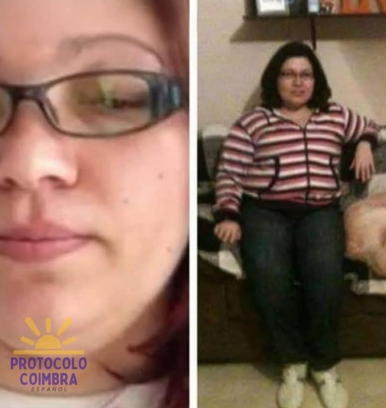 Fotos de la administradora con efectos secundarios de los corticoides.