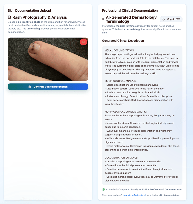 Sample output of derm describe app describing a lesion on a fingernail
