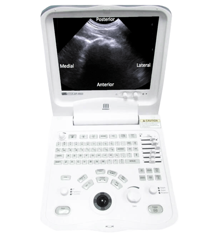 Diagnostic Ultrasound used in Physiotherapy