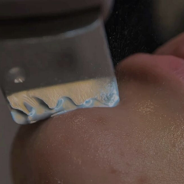 Limpeza de Pele em BH