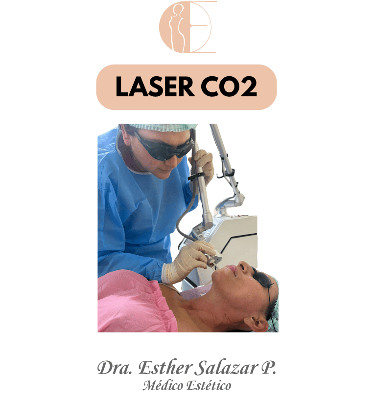 LASER CO2 GUAYAQUIL