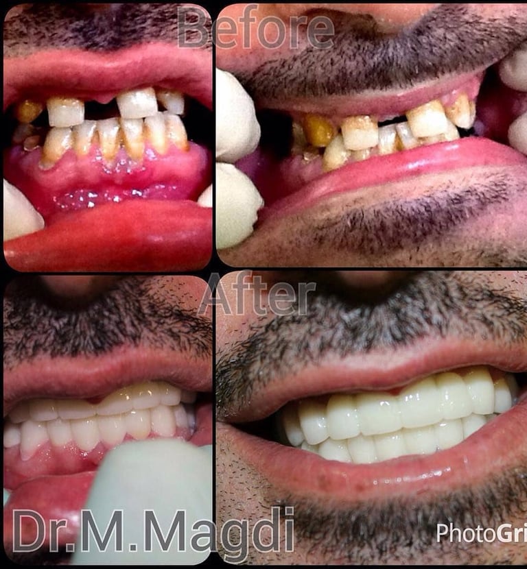 تقويم اسنان الكويت