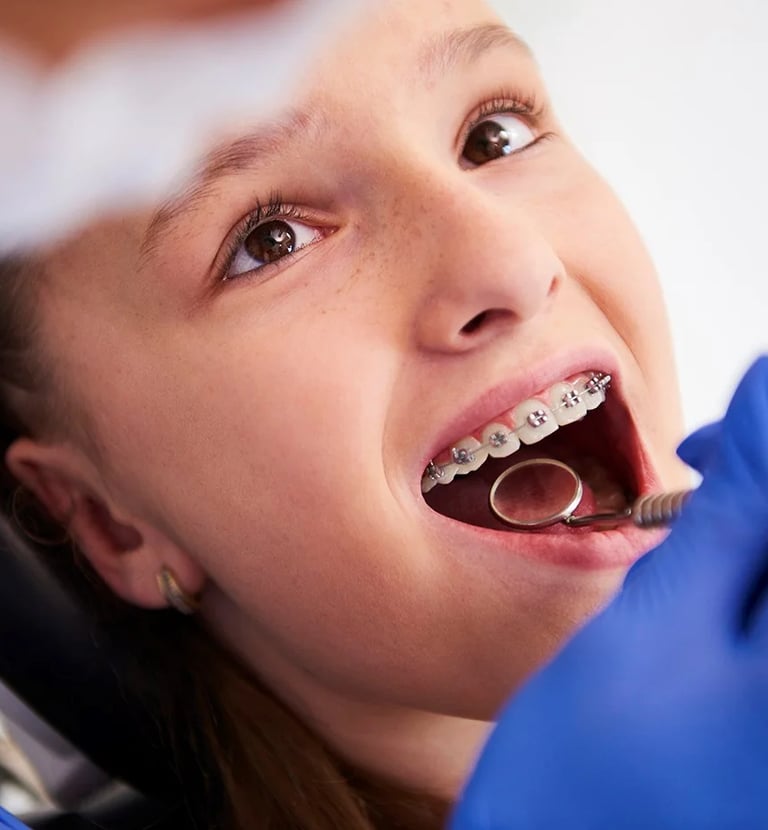 Mal-aligned teeth correction for beautiful smile at dentosculpt