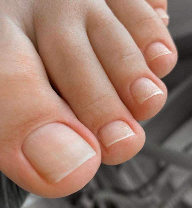 Higieninis pedikiūras