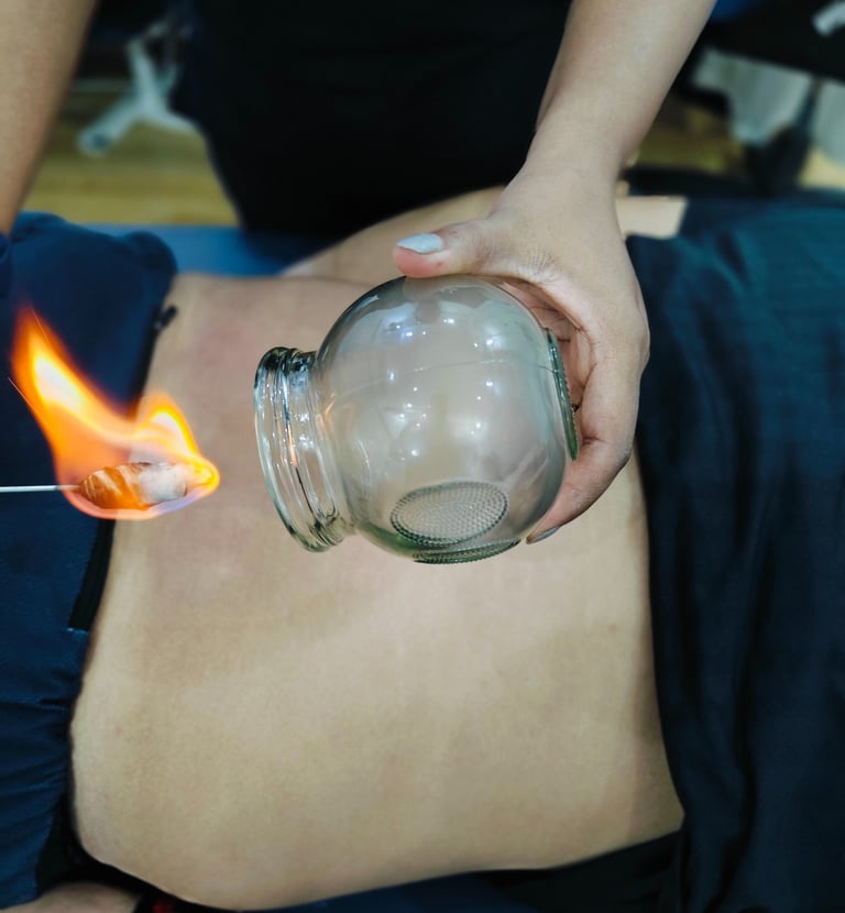 cupping therapy in Noida, Delhi, Ghaziabad, Greater Noida