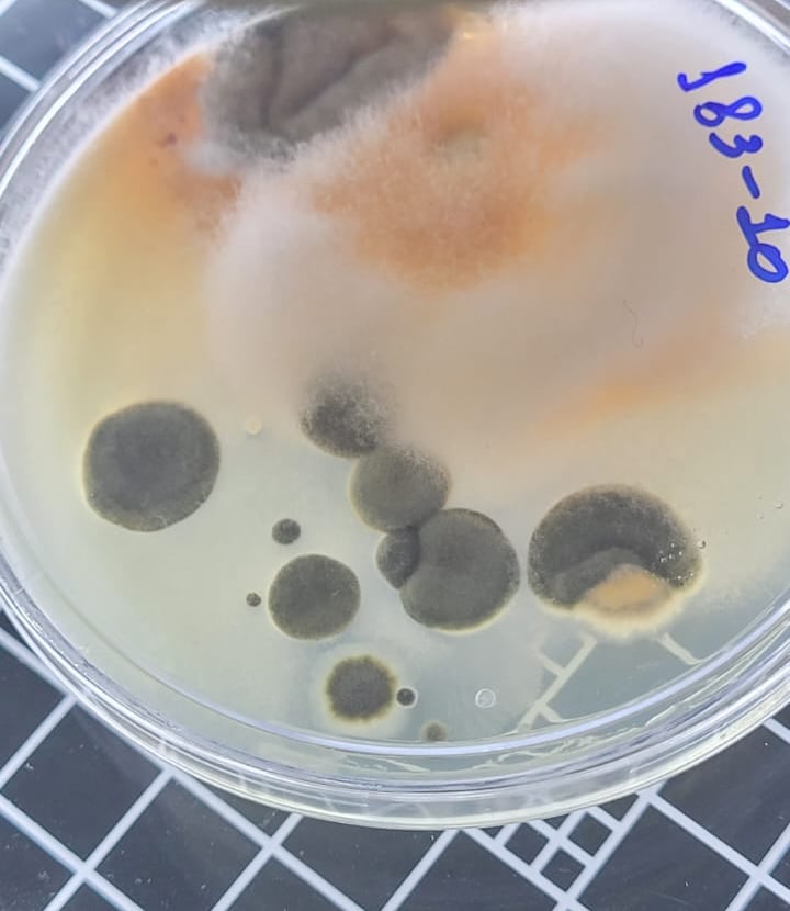 Recipiente de análise laboratorial contendo amostra de água com resultado positivo para Legionella, 