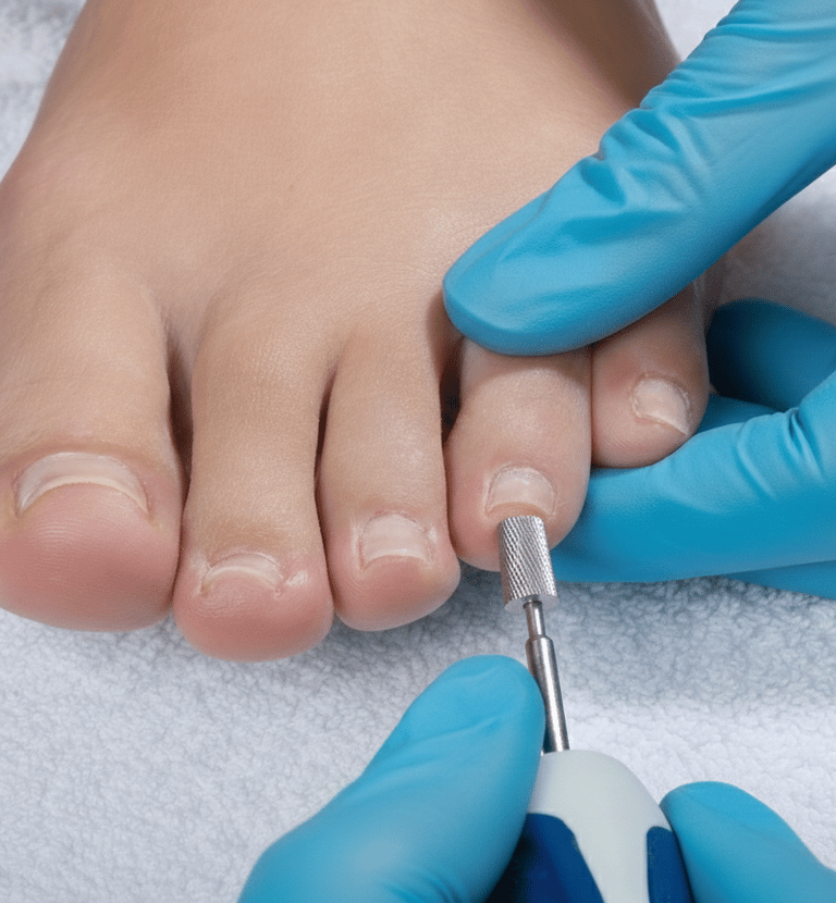 Professional podiatrist using an electric nail drill for a pedicure treatment ,fusspflege overath