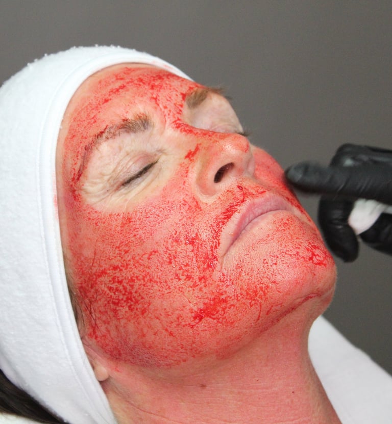 Ansigt under Vampire Facial behandling.