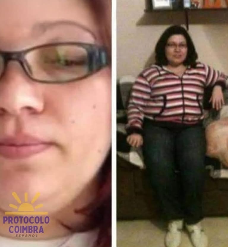 Photos of the administrator with side effects from corticosteroids.