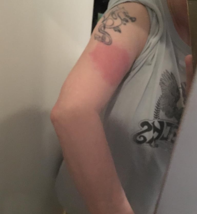 my mums arm