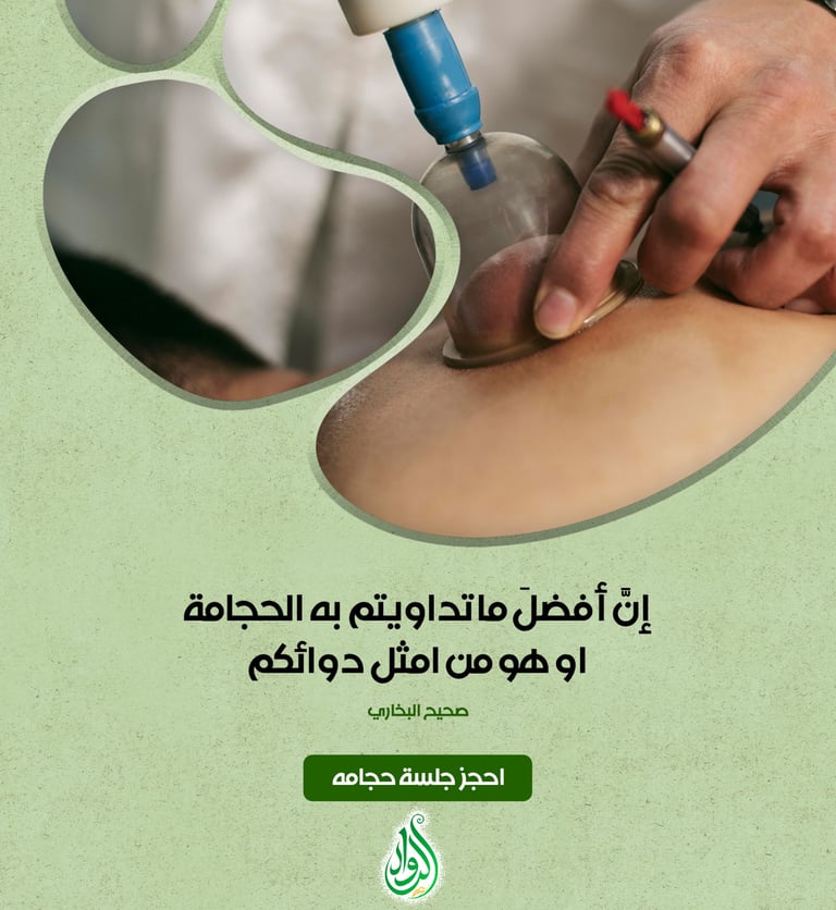 حجامه الرياض