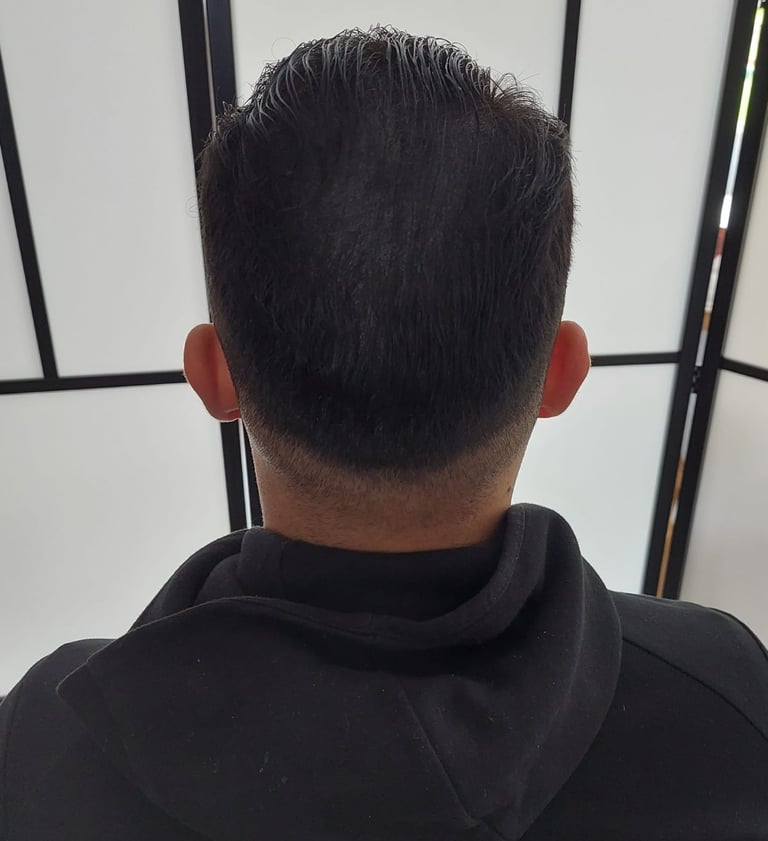 homme qui a fait une micropigmentation capillaire pour densifier sa chevelure