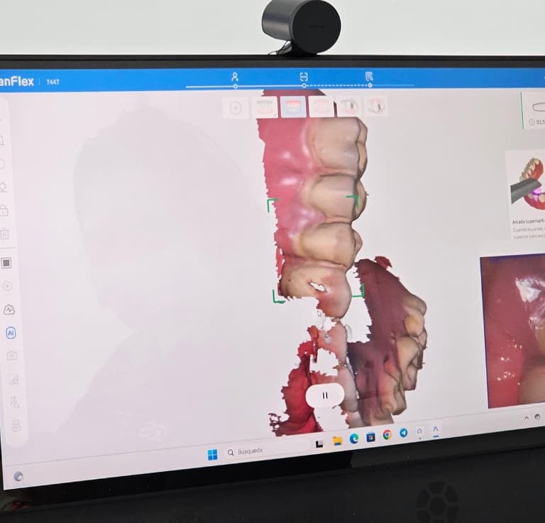 escáner intraoral 3D