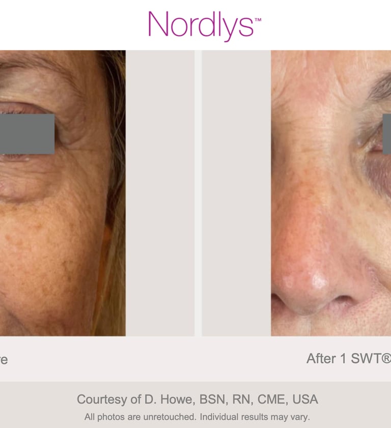 skin consultation session at skincare clinic in Hamilton Ontario