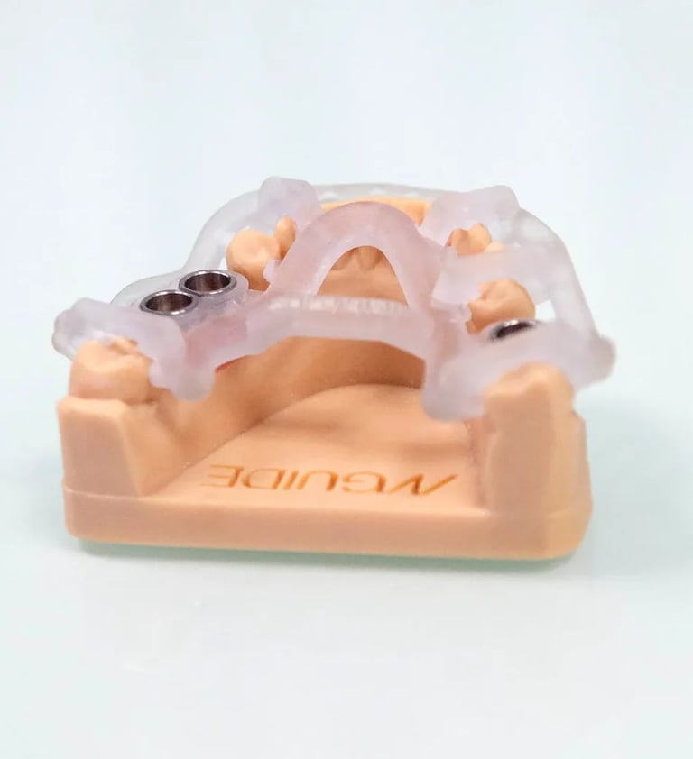 Implantes dentales con cirugía guiada en Sevilla