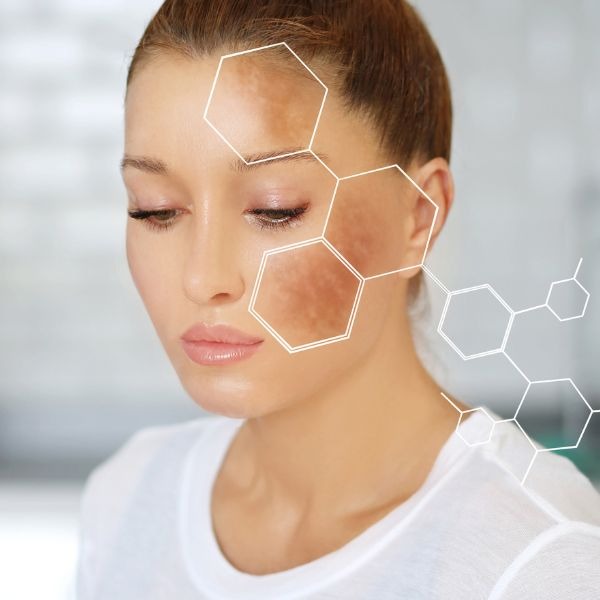 woman with dark spots on her face