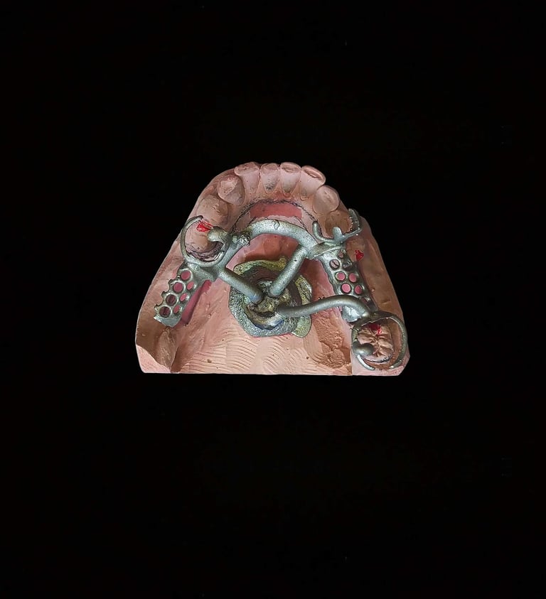 Removible estructura metalica