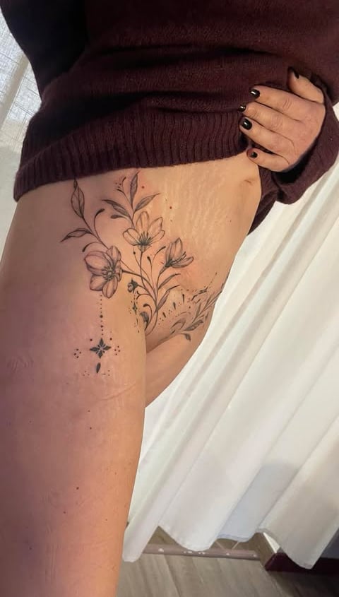 Une femme avec un tatouage sur sa cuisse sur cicatrice abdominoplastie montrant le côté de sa cuisse