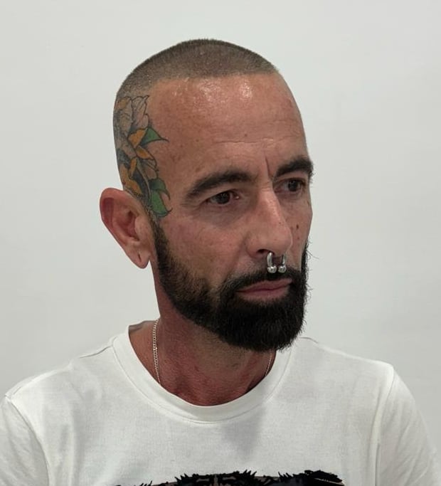 Tratamiento capilar avanzado contra alopecia