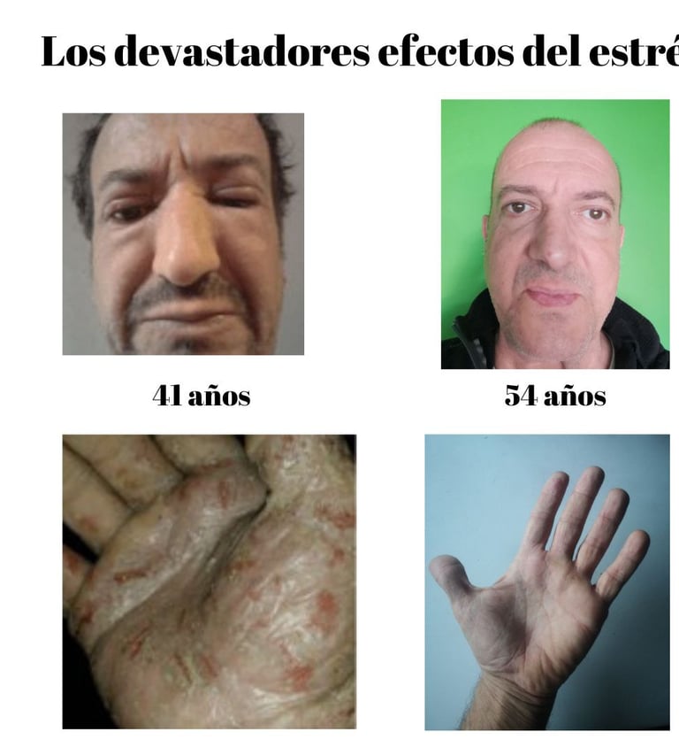 Los efectos del estrés
