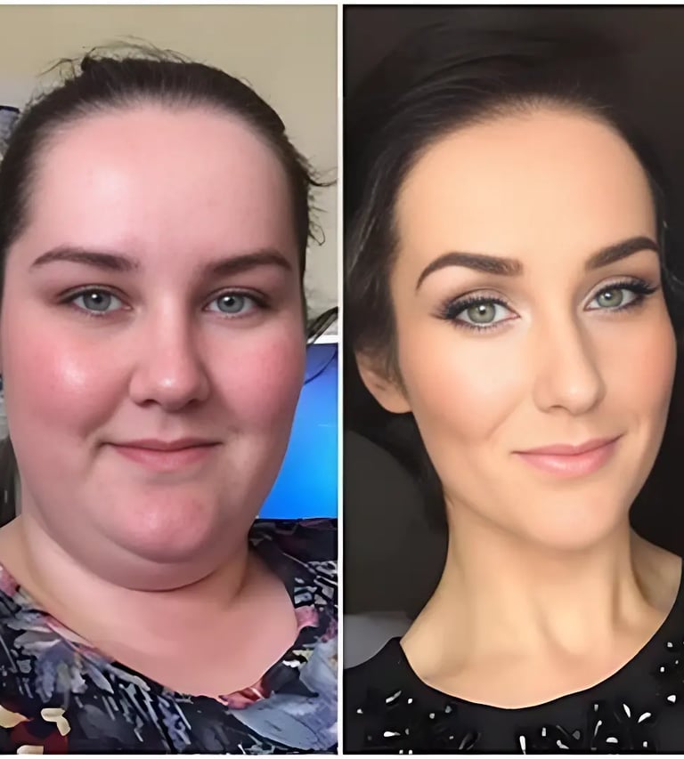 Wie funktionieren Ozem Patches Result One