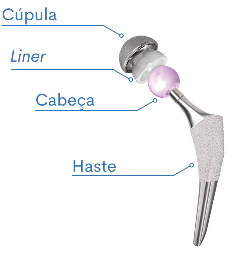 Partes de uma prótese do quadril