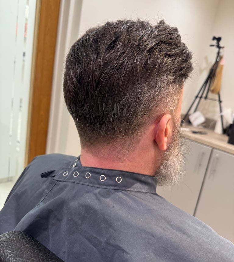 HairLabUK non surgical Hair Transplant in Hull