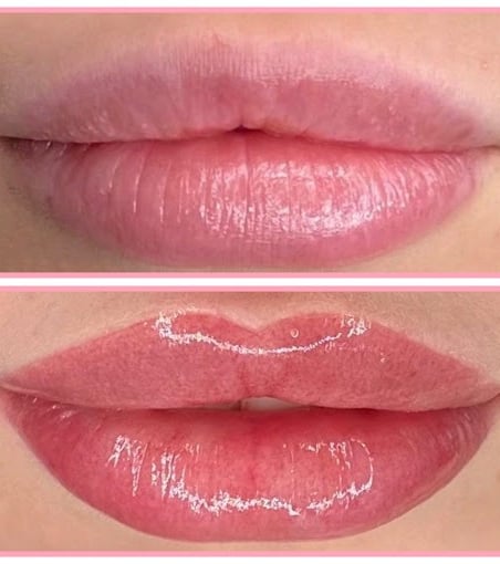 Permanent Make-up Lip Blush Vorher- / Nachher Fotos Lippenpigmentierung in der Nähe Linz Heilung