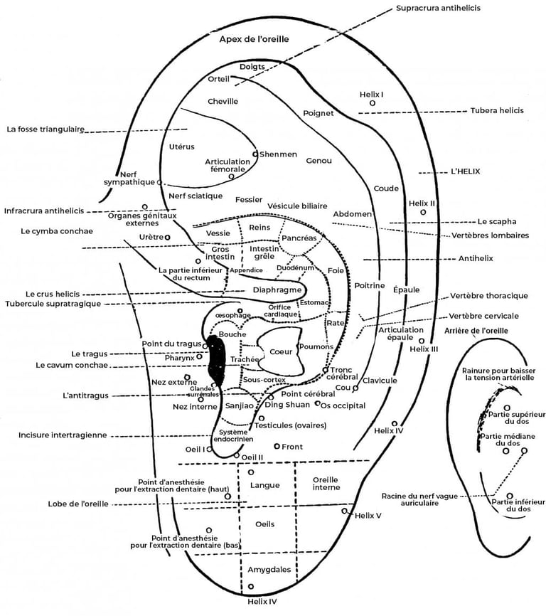 auriculotherapie aide pour mincir acupuncteur crolles