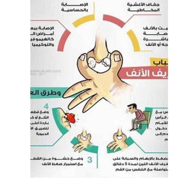 الاسباب