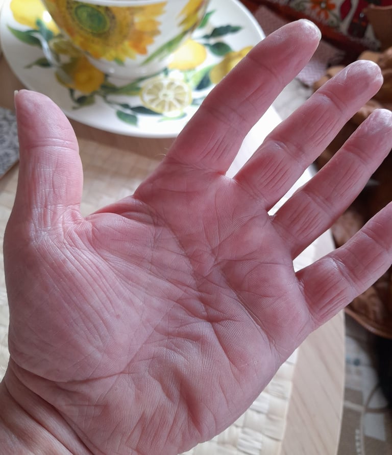 the left hand of rob hamilton showing the lines in the palm