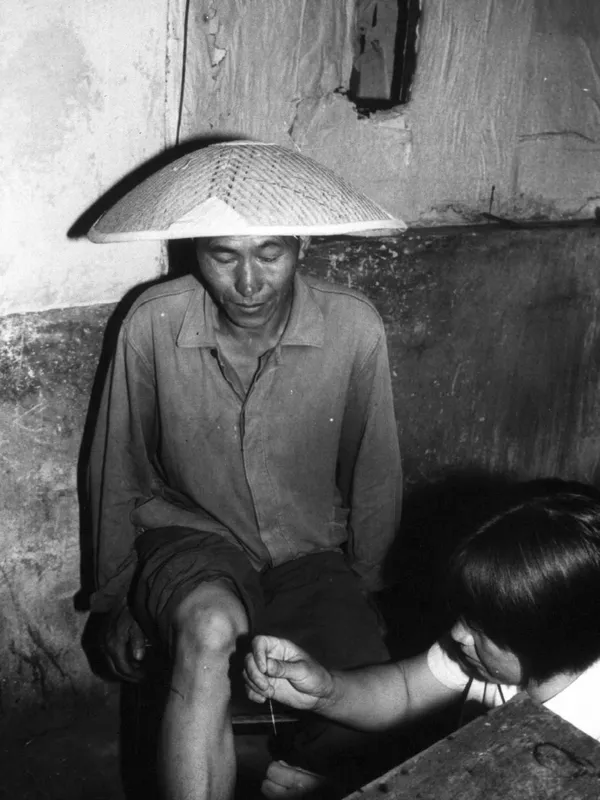 Acupuncture as traditionally practiced in China by "barefoot doctors" in community settings
