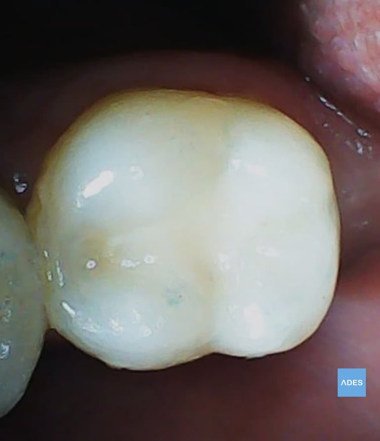empaste clinica dental badajoz