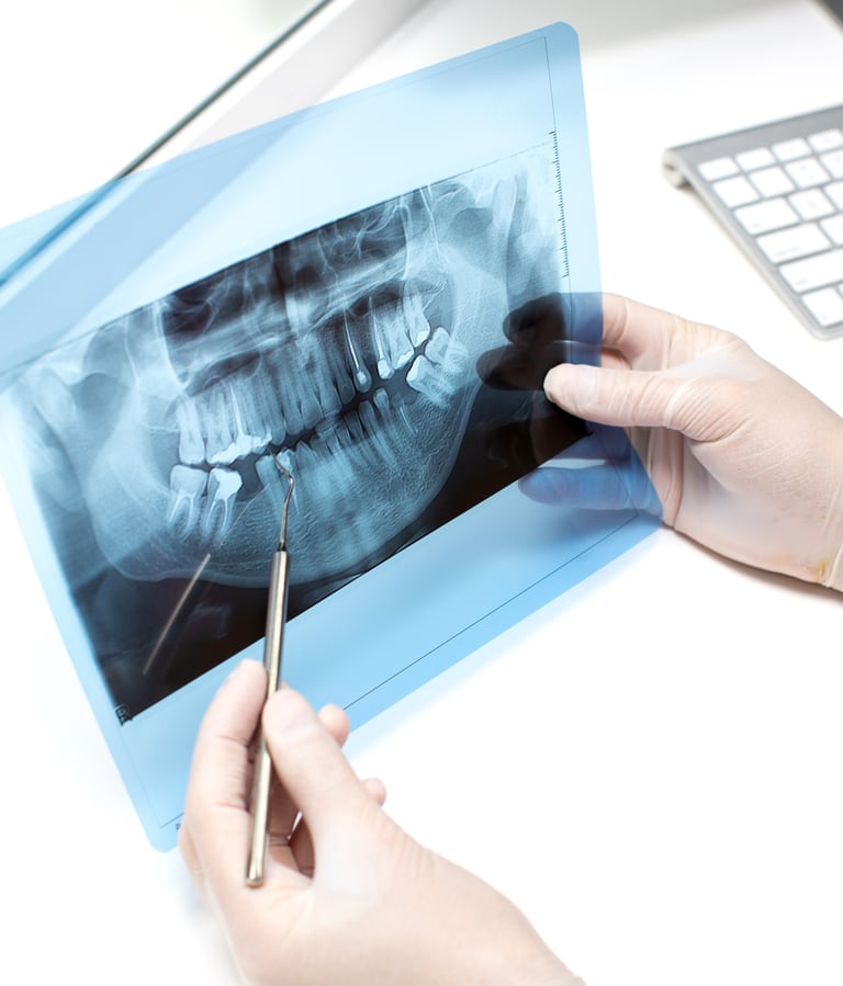 Endodontija Kanalų gydymas Palanga