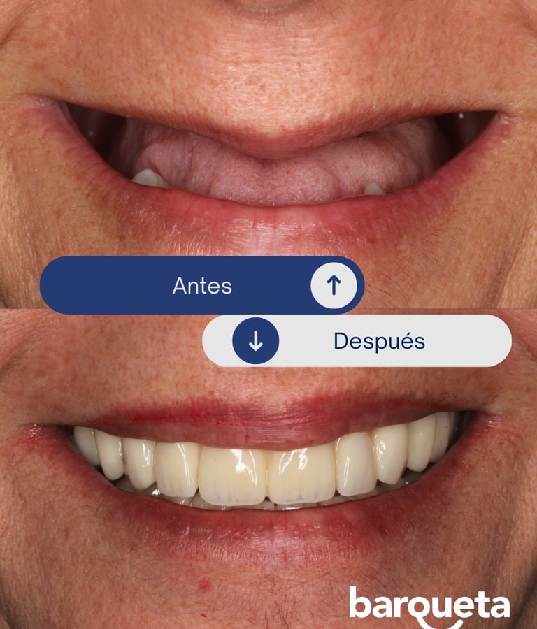 Paciente satisfecho tras un tratamiento de implantes dentales en nuetsra clínica dental de sevilla