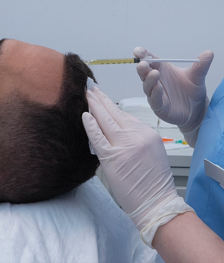 greffe de cheveux,زراعة الشعر الجزائر, perte de cheveux, تساقط الشعر, clinique greffe de cheveux,prp