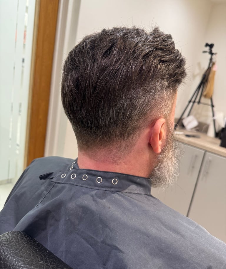 HairLabUK non surgical Hair Transplant in Hull