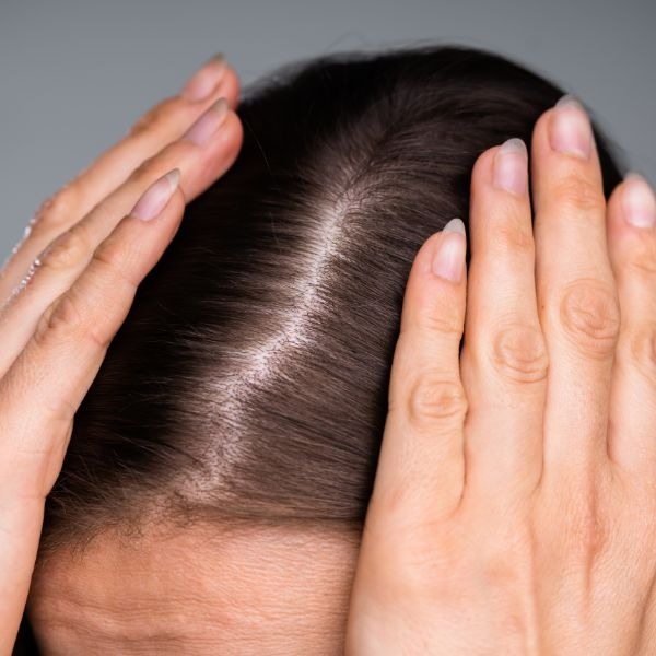 a woman with her hands on her head