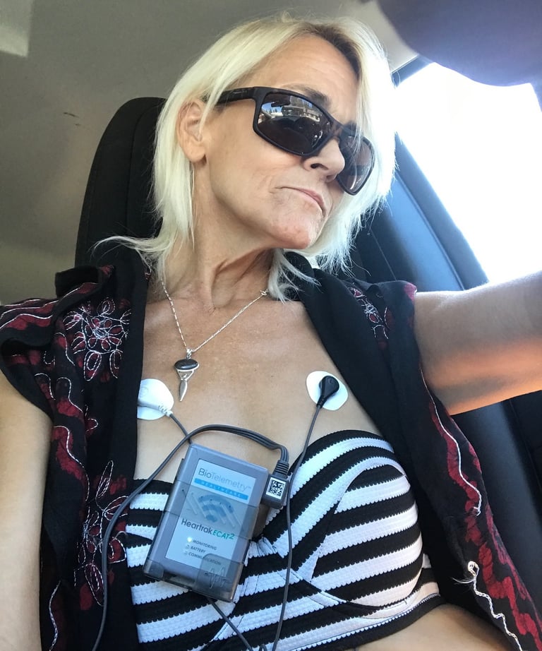 Heart Monitor after SCD