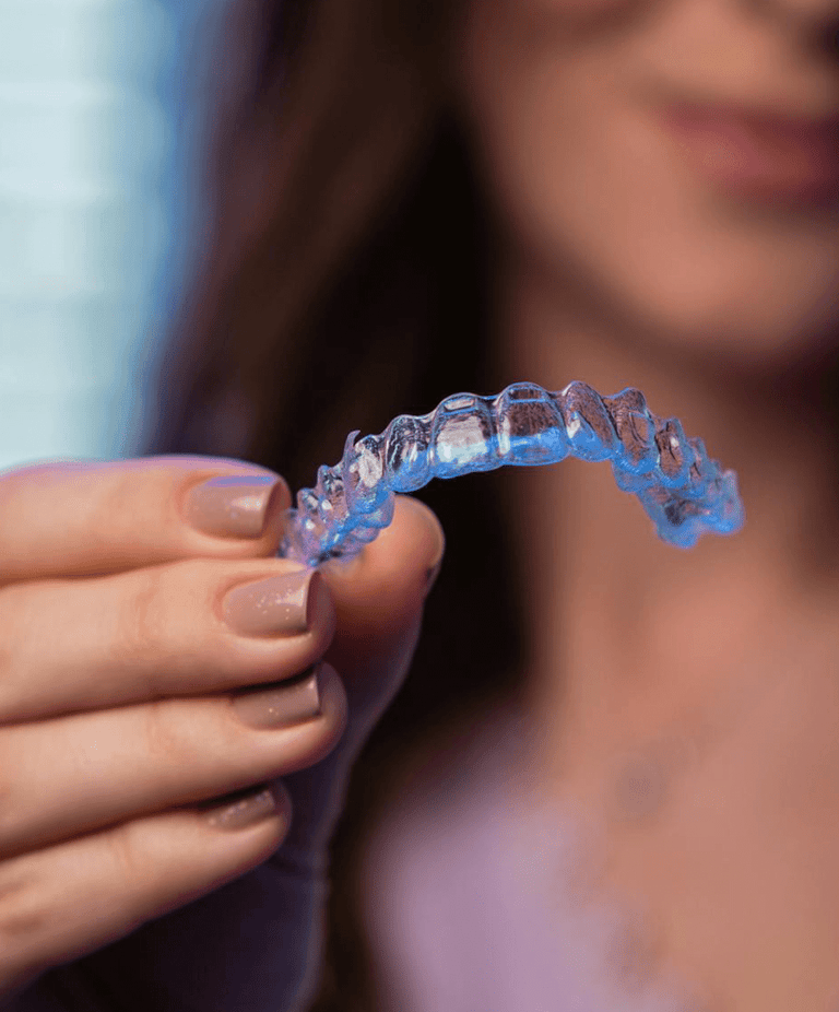 Digital smile design, providne folije za ispravljanje zuba, alajneri