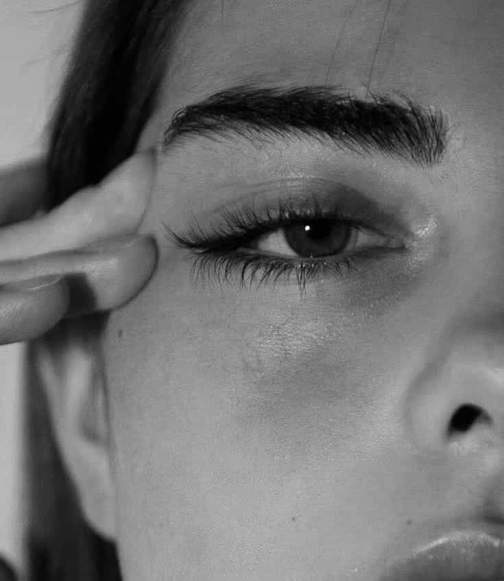 Lower Eyelid Surgery (Lower Blepharoplasty) Explanation Image From Macys Plastic Surgery