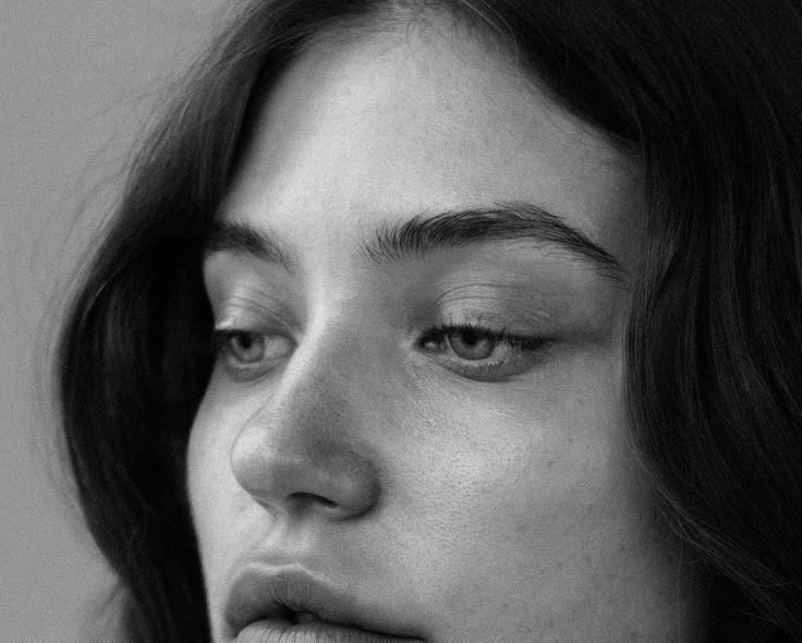 Eyelid surgery (blepharoplasty) explanation image from Macys Plastic Surgery