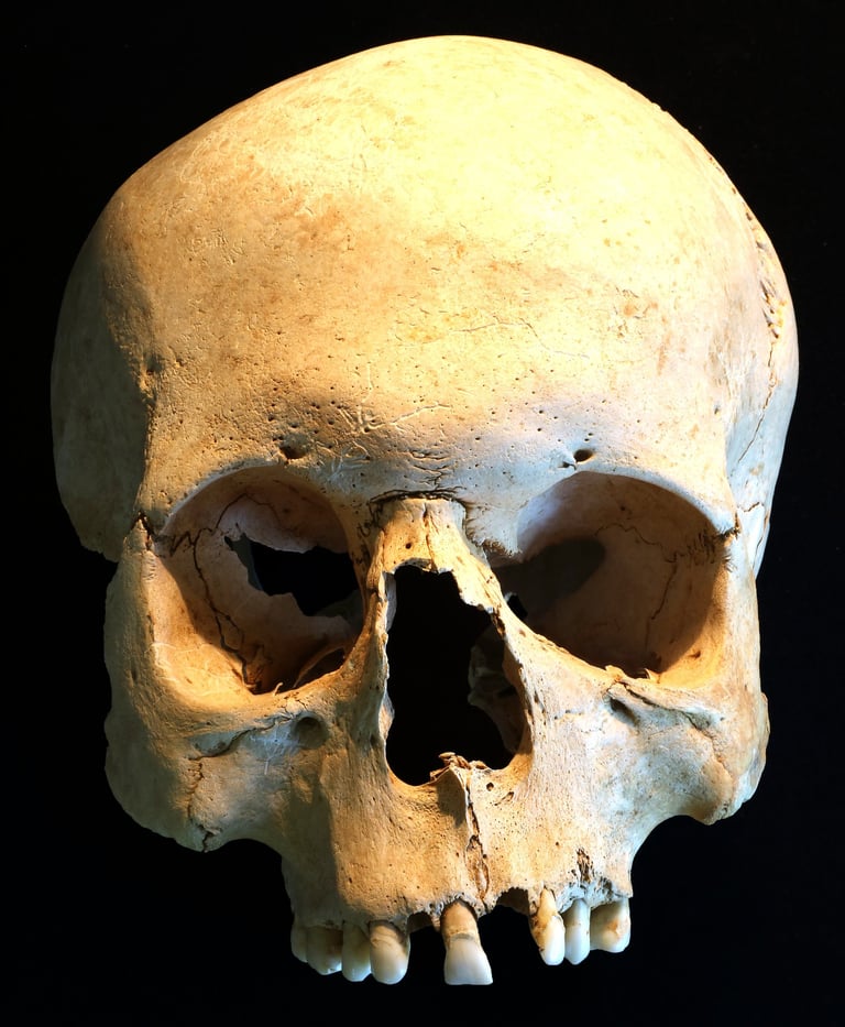 Asymmetry of the face