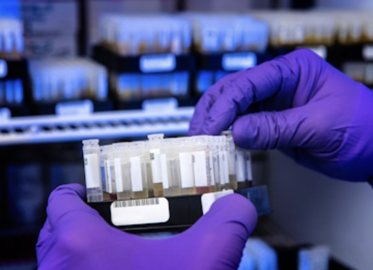 Laboratory technician processing diagnostic blood samples for neurological testing