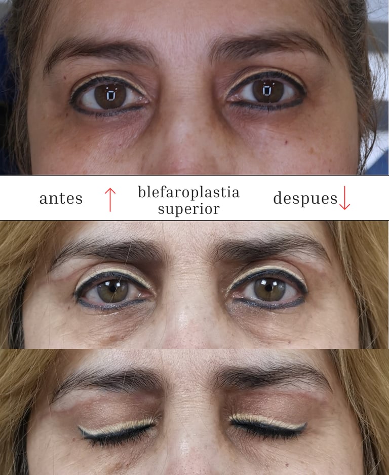 Cirugía Plástica y Rejuvenecimiento Dr. Fabián Orozco